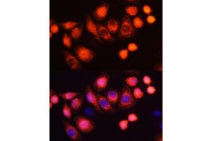 Immunofluorescence analysis of HeLa cells using HRAS antibody (ABIN6130448, ABIN6141983, ABIN6141985 and ABIN6215813) at dilution of 1:100 (40x lens). (HRAS 抗体  (AA 1-189))