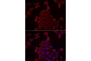 Immunofluorescence analysis of U2OS cells using PDHX antibody. (PDHX 抗体)
