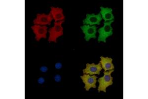 ALDOA Mouse Monoclonal Antibody staining HepG2 cells by IF/ICC. (ALDOA 抗体  (N-Term))