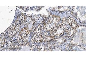 IHC analysis of KCNQ5 using anti-KCNQ5 antibody (ABIN7602178).
