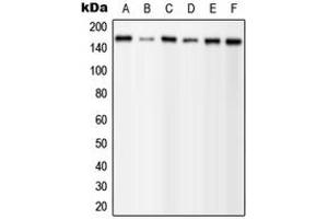 Western blot analysis of PLC gamma 1 (pY1253) expression in MCF7 EGF-treated (A), A431 (B), mouse brain (C), mouse liver (D), H9C2 EGF-treated (E) whole cell lysates. (Phospholipase C gamma 1 抗体  (C-Term, pTyr1253))