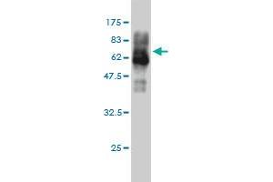 Western Blotting (WB) image for anti-Calcium/calmodulin-Dependent Protein Kinase IV (CAMK4) (AA 1-473) antibody (ABIN560153)