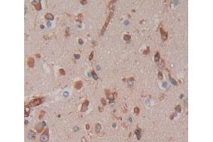IHC-P analysis of brain tissue, with DAB staining. (GTF3A 抗体  (AA 71-365))