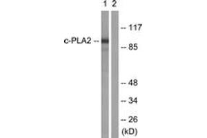 Western blot analysis of extracts from HeLa cells, treated with TNF-a 20ng/ml 30', using c-PLA2 (Ab-505) Antibody. (C-PLA2 (AA 471-520) 抗体)