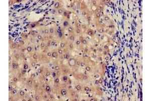 Immunohistochemistry of paraffin-embedded human liver tissue using ABIN7172206 at dilution of 1:100 (FUCA1 抗体  (AA 32-158))
