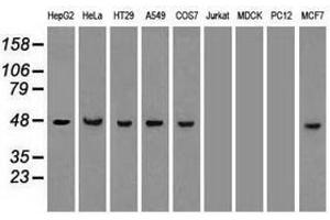 Image no. 3 for anti-Keratin 18 (KRT18) (AA 69-372) antibody (ABIN1491638) (Cytokeratin 18 抗体  (AA 69-372))