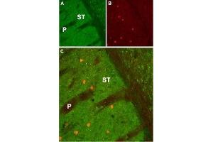 Expression of Muscarinic acetylcholine receptor M1 in mouse striatum - Immunohistochemical staining of mouse striatum (ST) using Anti-CHRM1 Antibody (ABIN7043060, ABIN7044580 and ABIN7044581). (CHRM1 抗体  (AA 227-353))