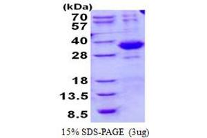 SplA/ryanodine Receptor Domain and SOCS Box Containing 2 (SPSB2) (AA 1-263) protein (His tag)