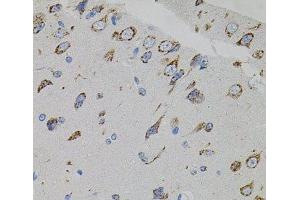 Immunohistochemistry of paraffin-embedded Rat brain using VEGFC Polyclonal Antibody (VEGFC 抗体)