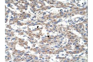 DUT antibody was used for immunohistochemistry at a concentration of 4-8 ug/ml. (Deoxyuridine Triphosphatase (DUT) (N-Term) 抗体)