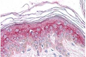 Human Skin: Formalin-Fixed, Paraffin-Embedded (FFPE) (GM2A 抗体  (N-Term))