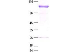 Western Blotting (WB) image for SRY (Sex Determining Region Y)-Box 5 (SOX5) protein (DYKDDDDK Tag) (ABIN2732465)