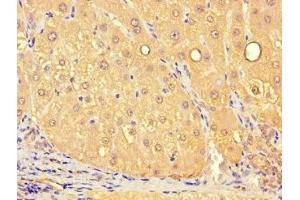 Immunohistochemistry (IHC) image for anti-Solute Carrier Family 25 (Mitochondrial Carrier, Citrate Transporter), Member 1 (Slc25a1) (AA 124-162) antibody (ABIN7159849)