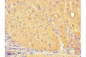 Immunohistochemistry of paraffin-embedded human liver tissue using ABIN7159849 at dilution of 1:100 (Slc25a1 抗体  (AA 124-162))