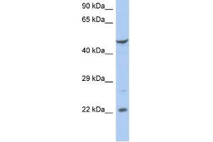 WB Suggested Anti-FLJ44894 Antibody Titration:  0. (FLJ44894 抗体  (N-Term))