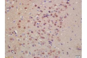 Formalin-fixed and paraffin embedded rat brain labeled with Rabbit Anti- Pro-Neuregulin Polyclonal Antibody, Unconjugated  at 1:200 followed by conjugation to the secondary antibody and DAB staining (Neuregulin 1 抗体  (AA 221-320))
