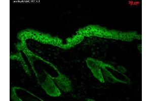 Immunohistochemistry (IHC) image for anti-Heat Shock Protein 90 (HSP90) antibody (FITC) (ABIN2481353)