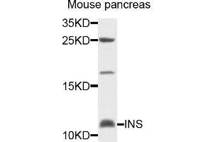 Western blot analysis of extracts of mouse pancreas cells, using INS antibody. (Insulin 抗体)