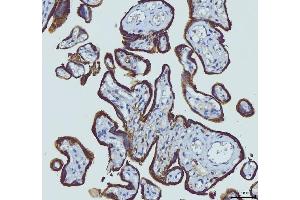 IHC analysis of HGS using anti-HGS antibody (ABIN7601207).