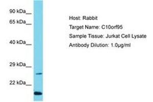 Image no. 1 for anti-Chromosome 10 Open Reading Frame 95 (C10ORF95) (N-Term) antibody (ABIN6750685) (C10ORF95 抗体  (N-Term))