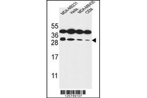 Western blot analysis of Syntaxin 10 / STX10 Antibody (N-term) in MDA-MB231, Hela, MDA-MB435, CEM cell line lysates (35ug/lane). (Syntaxin 10 抗体  (N-Term))