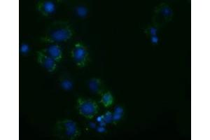 Anti-AK3 mouse monoclonal antibody (ABIN2452718) immunofluorescent staining of COS7 cells transiently transfected by pCMV6-ENTRY AK3 (RC204408). (Adenylate Kinase 3 抗体)