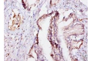 Immunohistochemistry of paraffin-embedded human prostate tissue using ABIN7152198 at dilution of 1:10 (eIF4EBP2 抗体  (AA 1-120))