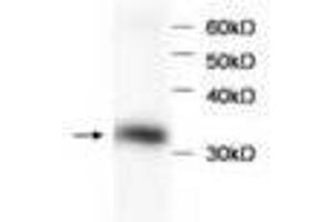 Image no. 1 for anti-Hemoglobin beta (HBB) antibody (ABIN791524) (Hemoglobin Subunit beta 抗体)