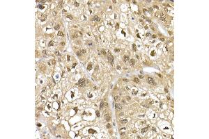 Immunohistochemistry (IHC) image for anti-Cullin 1 (CUL1) (AA 500-776) antibody (ABIN3015864)