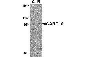 Western blot analysis of CARD10 expression in EL4 cell lysate with AP30183PU-N CARD10 antibody at (A) 5 and (B) 10 μg /ml. (CARD10 抗体)