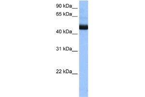WB Suggested Anti-PIGK Antibody Titration:  0. (PIGK 抗体  (N-Term))