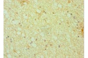 Immunohistochemistry of paraffin-embedded human brain tissue using ABIN7150804 at dilution of 1:100 (Dynactin 1 抗体  (AA 1084-1278))