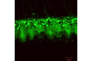 Immunohistochemistry (IHC) image for anti-DnaJ (Hsp40) Homolog, Subfamily C, Member 5 (DNAJC5) (AA 182-198), (C-Term) antibody (ABIN1742330)