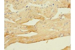 Immunohistochemistry of paraffin-embedded human heart tissue using ABIN7175582 at dilution of 1:100 (CACNA2D4 抗体  (AA 934-1115))
