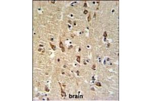 Immunohistochemistry (Paraffin-embedded Sections) (IHC (p)) image for anti-Small Glutamine-Rich Tetratricopeptide Repeat (TPR)-Containing, beta (SGTB) (AA 71-100), (N-Term) antibody (ABIN651267)