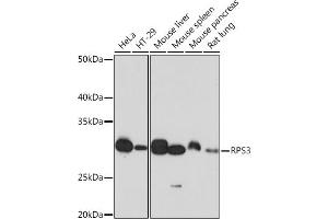 Western blot analysis of extracts of various cell lines, using RPS3 Rabbit mAb (ABIN7270025) at 1:1000 dilution. (RPS3 抗体)