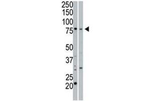 cGKI beta antibody used in western blot to detect cGKIbeta in 293 cell lysate (Lane 1) and mouse small intestine tissue lysate (2).