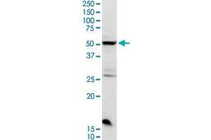 CHRDL2 MaxPab rabbit polyclonal antibody. (CHRDL2 抗体  (AA 1-451))