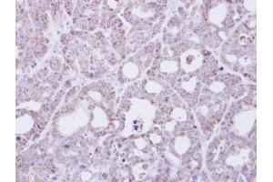 IHC-P Image Immunohistochemical analysis of paraffin-embedded NCI-N87 xenograft, using Transmembrane protein 147, antibody at 1:500 dilution. (TMEM147 抗体)