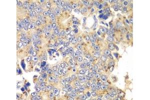 Immunohistochemistry (Paraffin-embedded Sections) (IHC (p)) image for anti-Protein Interacting With Protein Kinase C, alpha 1 (PICK1) antibody (ABIN7257176)