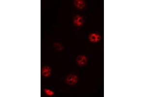 ABIN6272469 staining HepG2 by IF/ICC. (ZNF785 抗体)