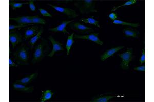 Immunofluorescence (IF) image for anti-Formin 1 (FMN1) (AA 1-109) antibody (ABIN949949)