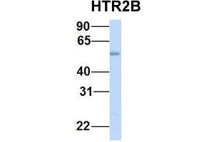 Western Blotting (WB) image for anti-Serotonin Receptor 2B (HTR2B) (N-Term) antibody (ABIN2779377)