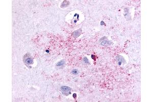 Anti-PAK6 antibody IHC of human brain, neurons and glia. (PAK6 抗体  (Linker Domain))