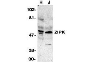 Western Blotting (WB) image for anti-Death-Associated Protein Kinase 3 (DAPK3) (Middle Region) antibody (ABIN1031183) (DAPK3 抗体  (Middle Region))