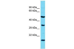 Host: Rabbit  Target Name: l7Rn6  Sample Tissue: Rat Spleen lysates  Antibody Dilution: 1. (C11orf73 抗体  (N-Term))