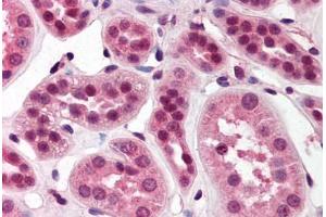 Human Kidney (formalin-fixed, paraffin-embedded) stained with SKI antibody ABIN214477 at 2. (SKI 抗体  (N-Term))