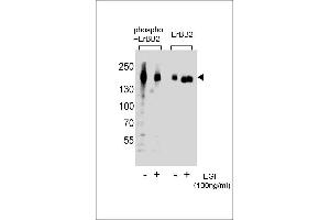 Western blot analysis of extracts from A431 cells, untreated or treated with EGF, 100 ng/mL, using Phospho-ERBB2- or ERBB2 Antibody (right). (ErbB2/Her2 抗体  (pTyr1127))