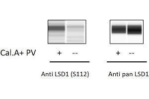 Jurkat cells were treated with Calyculin A and Pervanadate. (LSD1 ELISA 试剂盒)