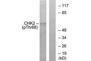 Western blot analysis of extracts from Jurkat cells treated with UV, using Chk2 (Phospho-Thr68) Antibody. (CHEK2 抗体  (pThr68))